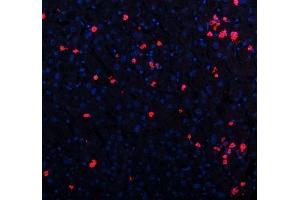 IF analysis of CXCL12 using anti-CXCL12 antibody (ABIN6719467). (CXCL12 antibody  (AA 24-93))