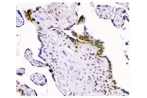 IHC analysis of HAUSP/USP7 using anti-HAUSP/USP7 antibody (ABIN6719603). (USP7 antibody  (AA 258-483))