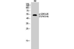 Western Blotting (WB) image for anti-Glycogen Synthase Kinase 3 alpha/beta (GSK3a/b) (pTyr216), (pTyr279) antibody (ABIN3182022) (GSK3 alpha/beta antibody  (pTyr216, pTyr279))