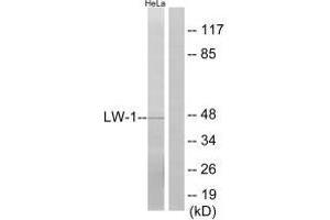 Western blot analysis of extracts from HeLa cells, using LW-1 antibody. (HSFX1 antibody  (N-Term))