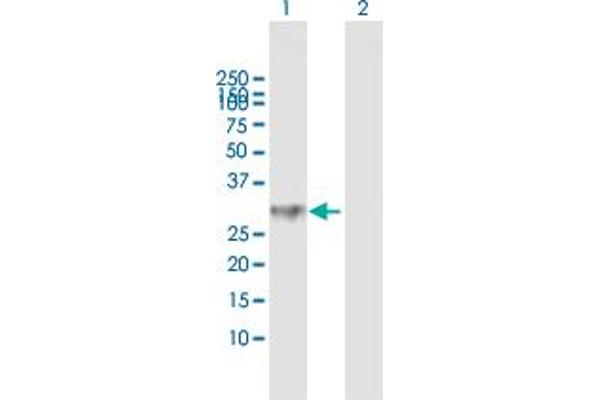 ABCC10 antibody  (AA 1-282)
