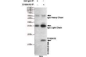 Immunoprecipitation analysis of Hela cell lysates using S100A10 mouse mAb. (S100A10 antibody)