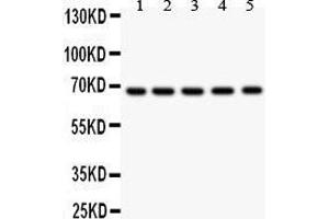 Anti- HNF1 antibody, Western blotting All lanes: Anti HNF1  at 0.