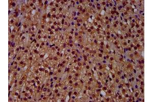 IHC image of ABIN7144968 diluted at 1:500 and staining in paraffin-embedded human adrenal gland tissue performed on a Leica BondTM system. (RECQL4 antibody  (AA 200-337))