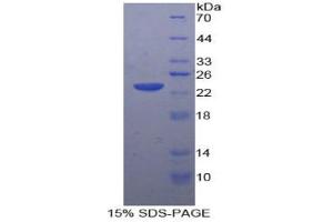 SDS-PAGE analysis of Rabbit MMP12 Protein. (MMP12 Protein)