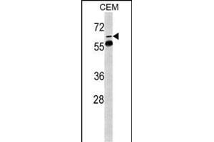 Western blot analysis of FKBP10 Antibody (N-term) (ABIN391572 and ABIN2841509) in CEM cell line lysates (35 μg/lane). (FKBP10 antibody  (AA 57-87))