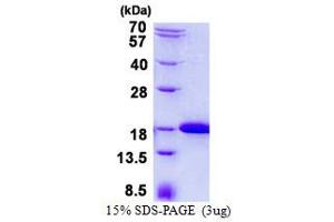 Image no. 1 for Intraflagellar Transport 20 Homolog (IFT20) protein (His tag) (ABIN1098401)