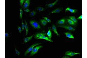 anti-Solute Carrier Family 25 (S-Adenosylmethionine Carrier), Member 26 (SLC25A26) (AA 116-151) antibody