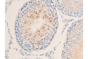 Immunohistochemistry (IHC) image for anti-Nuclear Factor of kappa Light Polypeptide Gene Enhancer in B-Cells Inhibitor, epsilon (NFKBIE) (pSer161) antibody (ABIN6255101)