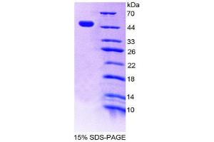 SDS-PAGE (SDS) image for Tumor Necrosis Factor (Ligand) Superfamily, Member 8 (TNFSF8) (AA 69-233) protein (His tag,GST tag) (ABIN2122638)
