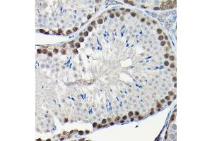 Immunohistochemistry of paraffin-embedded human placenta using Integrin alpha V (ITGAV/CD51) Rabbit mAb (ABIN7267922) at dilution of 1:100 (40x lens). (CD51 antibody)