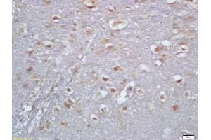 Formalin-fixed and paraffin embedded rat brain labeled with Anti-TBX6 Polyclonal Antibody, Unconjugated (ABIN1714574) at 1:200 followed by conjugation to the secondary antibody and DAB staining (T-Box 6 antibody  (AA 241-330))