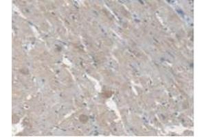 IHC-P analysis of Rat Heart Tissue, with DAB staining. (CES1 antibody  (AA 19-300))