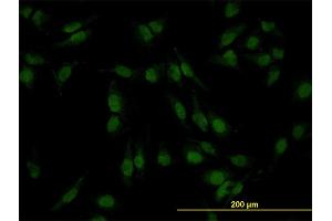 Immunofluorescence of monoclonal antibody to SMAD4 on HeLa cell. (SMAD4 antibody  (AA 1-552))