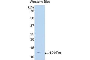 Detection of Recombinant TGFa, Human using Polyclonal Antibody to Transforming Growth Factor Alpha (TGFa) (TGFA antibody  (AA 24-98))