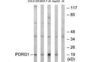 Western blot analysis of extracts from Jurkat/COLO/MCF-7/HepG2 cells, using PDRG1 Antibody. (PDRG1 antibody  (AA 58-107))
