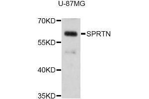 Western blot analysis of extracts of U-87MG cells, using SPRTN Antibody (ABIN5998940) at 1:3000 dilution. (Spartan antibody)