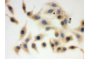 Immunocytochemistry (ICC) image for anti-Fatty Acid Synthase (FASN) (AA 1-226) antibody (ABIN4950995)