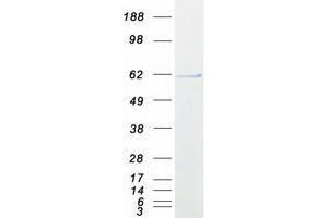 Western Blotting (WB) image for RAB Guanine Nucleotide Exchange Factor (GEF) 1 (RABGEF1) protein (Myc-DYKDDDDK Tag) (ABIN2730380)