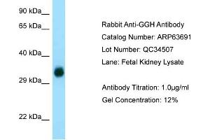 Western Blotting (WB) image for anti-gamma-Glutamyl Hydrolase (Conjugase, Folylpolygammaglutamyl Hydrolase) (GGH) (C-Term) antibody (ABIN2789590) (GGH antibody  (C-Term))