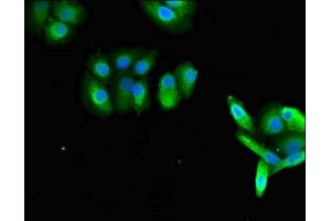 Immunofluorescent analysis of HepG2 cells using ABIN7167270 at dilution of 1:100 and Alexa Fluor 488-congugated AffiniPure Goat Anti-Rabbit IgG(H+L) (RAB27A antibody  (AA 2-221))