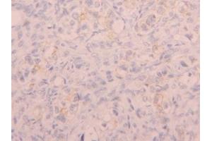 #VALUE! (CD5L antibody  (AA 133-256))