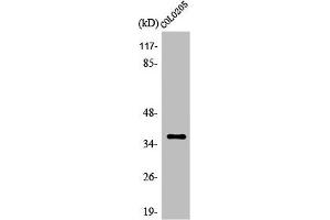 Western Blot analysis of HeLa cells using Olfactory receptor 52E5 Polyclonal Antibody (OR52E5 antibody  (Internal Region))