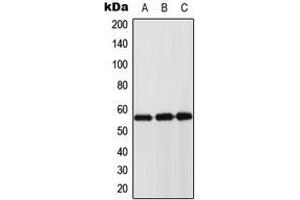 Western blot analysis of Cytokeratin 8 expression in DLD (A), mouse muscle (B), rat muscle (C) whole cell lysates. (KRT8 antibody  (Center))