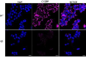 Immunocytochemical staining of HeLa cells using C1QBP antibody (ABIN7798136), 1:1,000), Top panel: wild-type (WT), Bottom panal: C1QBP shRNA knockdown (KD). (Recombinant C1QBP antibody)