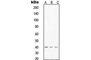 Western blot analysis of TIN2 expression in MCF7 (A), HeLa (B), Jurkat (C) whole cell lysates.