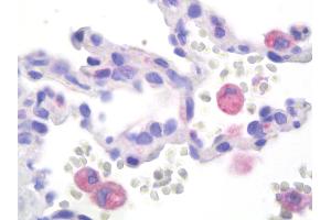 Anti-HEXA antibody IHC staining of human lung. (Hexosaminidase A antibody)