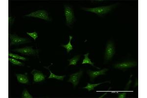 Immunofluorescence (IF) image for anti-Nuclear Factor of kappa Light Polypeptide Gene Enhancer in B-Cells Inhibitor, alpha (NFKBIA) (AA 1-317) antibody (ABIN1326940)