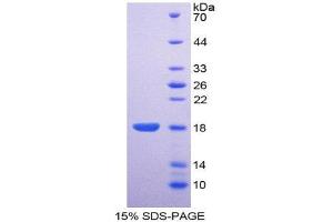 SDS-PAGE (SDS) image for Ectonucleotide Pyrophosphatase/phosphodiesterase 1 (ENPP1) (AA 625-780) protein (His tag) (ABIN2120982) (ENPP1 Protein (AA 625-780) (His tag))
