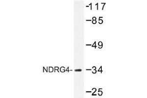Image no. 1 for anti-NDRG Family Member 4 (NDRG4) antibody (ABIN317933) (NDRG4 antibody)
