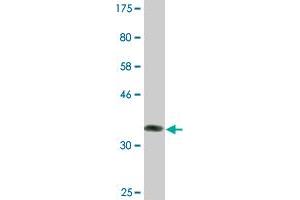 Western Blot detection against Immunogen (36. (BARX Homeobox 2 antibody  (AA 161-260))