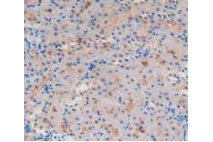 Figure. (GSTA4 antibody  (AA 2-222))