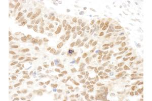 Immunohistochemistry (IHC) image for anti-Family with Sequence Similarity 175, Member A (FAM175A) (AA 400-409) antibody (ABIN7448401)
