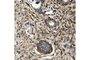 IHC analysis of non-muscle Myosin IIB/MYH10 using anti-non-muscle Myosin IIB/MYH10 antibody (ABIN7603186).