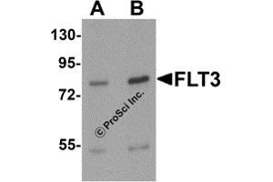 Western Blotting (WB) image for anti-Fms-Related tyrosine Kinase 3 (FLT3) (N-Term) antibody (ABIN1077372) (FLT3 antibody  (N-Term))