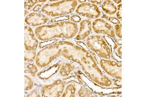 Immunohistochemistry of paraffin-embedded rat kidney using Prohibitin Rabbit pAb (ABIN3020627, ABIN3020628, ABIN3020629 and ABIN6213601) at dilution of 1:25 (40x lens).