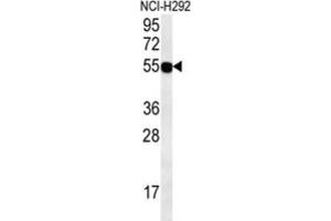 Western Blotting (WB) image for anti-Zinc Finger Protein 492 (ZNF492) antibody (ABIN2995742) (ZNF492 antibody)