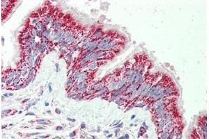 Human Bronchus: Formalin-Fixed, Paraffin-Embedded (FFPE) (TTLL4 antibody  (AA 326-338))