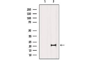 Western blot analysis of extracts from Mouse brain, using MED29 Antibody. (MED29 antibody  (Internal Region))