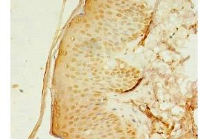 Immunohistochemistry of paraffin-embedded human skin tissue using ABIN7142992 at dilution of 1:100 (SMPDL3A antibody  (AA 51-350))