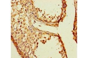 Immunohistochemistry of paraffin-embedded human testis tissue using ABIN7173143 at dilution of 1:100 (TMEM213 antibody  (AA 30-60))