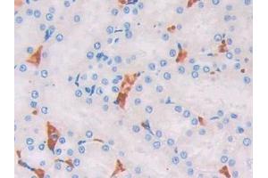 Used in DAB staining on fromalin fixed paraffin- embedded kidney tissue (UCP2 antibody  (AA 99-216))