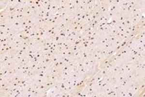 Immunohistochemistry (Paraffin-embedded Sections) (IHC (p)) image for anti-Sad1 and UNC84 Domain Containing 2 (SUN2) antibody (ABIN7075502)