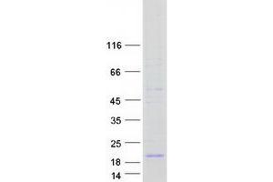 Western Blotting (WB) image for ATPase, H+ Transporting, Lysosomal 16kDa, V0 Subunit C (ATP6V0C) protein (Myc-DYKDDDDK Tag) (ABIN2715051)