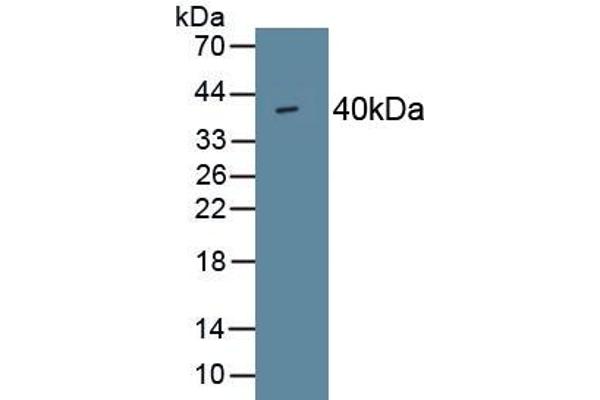 PINP antibody