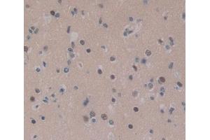 Used in DAB staining on fromalin fixed paraffin- embedded brain tissue (CEBPD antibody  (AA 51-252))